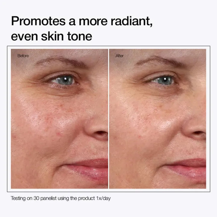 Urapra Glycolic Acid Toning Solution 7% Strength for Skin Care